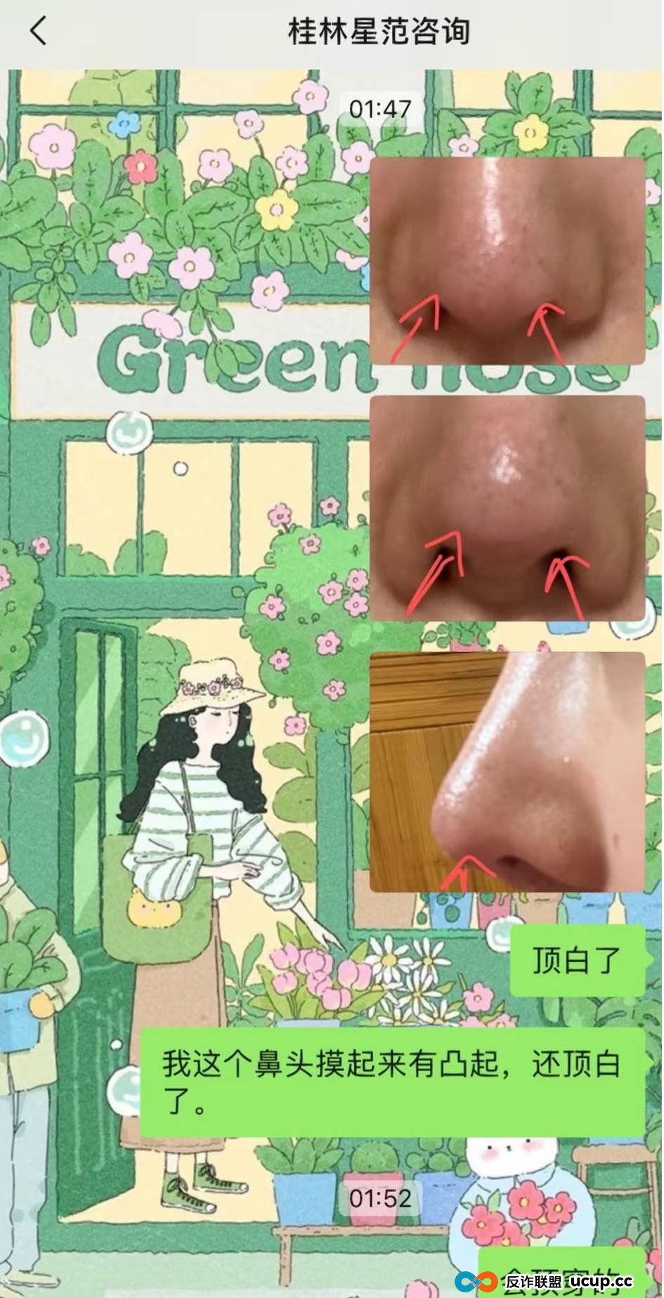 被曝用异体骨隆鼻之后,桂林星范整形如何重建消费者信任?(9) 被曝用异体骨隆鼻之后,桂林星范整形如何重建消费者信任?(9)